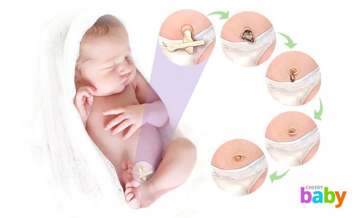В первые дни жизни новорожденного пупок тоже требует вашего внимания